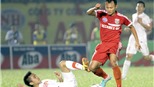Cựu vương V-League B.BD: Lại có sóng ngầm?